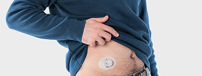 Monitoraggio continuo della glicemia: arriva il cerotto digitale di Menarini Diagnostics