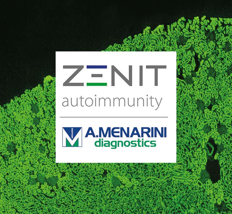 Autoimmunità
