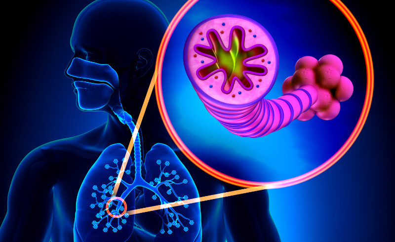 chronic obstructive pulmonary disease